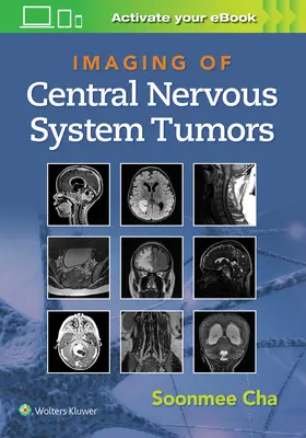 Imaging dei tumori del sistema nervoso centrale - Imaging of Central Nervous System Tumors