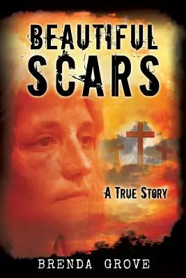 Belle cicatrici - Beautiful Scars