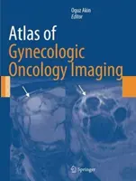 Atlante di diagnostica per immagini in oncologia ginecologica - Atlas of Gynecologic Oncology Imaging