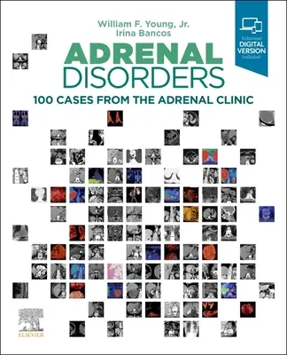 Disturbi surrenalici: 100 casi dalla clinica surrenalica - Adrenal Disorders: 100 Cases from the Adrenal Clinic