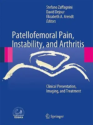 Dolore, instabilità e artrite femorale: Presentazione clinica, imaging e trattamento - Patellofemoral Pain, Instability, and Arthritis: Clinical Presentation, Imaging, and Treatment