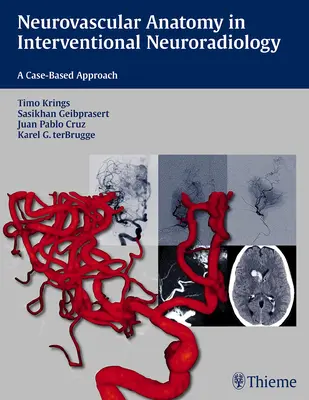 Anatomia neurovascolare in neuroradiologia interventistica: Un approccio basato sul caso - Neurovascular Anatomy in Interventional Neuroradiology: A Case-Based Approach