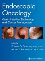 Oncologia endoscopica - Endoscopic Oncology