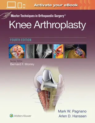 Tecniche Master in Chirurgia Ortopedica: Artroplastica del ginocchio - Master Techniques in Orthopedic Surgery: Knee Arthroplasty