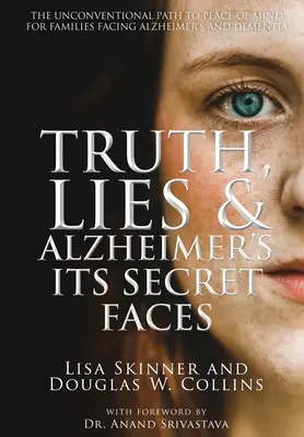 Verità, bugie e Alzheimer: I suoi volti segreti - Truth, Lies & Alzheimer's: Its Secret Faces