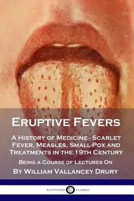 Febbri eruttive: Una storia della medicina - Scarlattina, morbillo, vaiolo e trattamenti nel XIX secolo - Un corso di lezioni. - Eruptive Fevers: A History of Medicine - Scarlet Fever, Measles, Small-Pox and Treatments in the 19th Century - Being a Course of Lectu