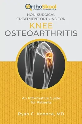 Opzioni di trattamento non chirurgico per l'osteoartrite del ginocchio: Una guida informativa per i pazienti - Non-Surgical Treatment Options for Knee Osteoarthritis: An Informative Guide for Patients
