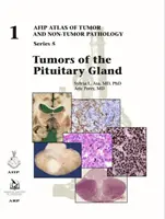 Tumori dell'ipofisi - Tumors of the Pituitary Gland