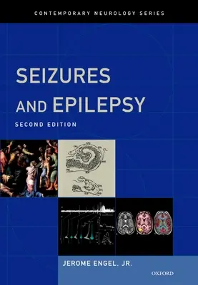 Crisi epilettiche ed epilessia - Seizures and Epilepsy