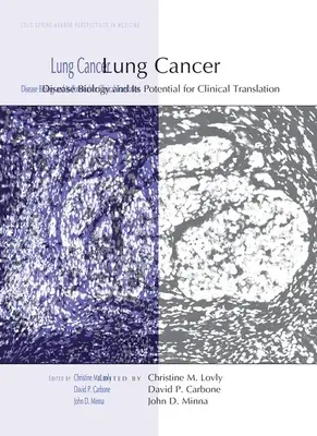 Cancro al polmone: La biologia della malattia e il suo potenziale per la traduzione clinica - Lung Cancer: Disease Biology and Its Potential for Clinical Translation