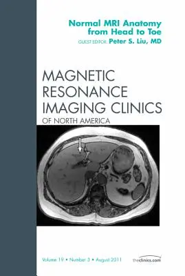 Anatomia normale della risonanza magnetica dalla testa ai piedi, un numero di Magnetic Resonance Imaging Clinics: Volume 19-3 - Normal MR Anatomy from Head to Toe, an Issue of Magnetic Resonance Imaging Clinics: Volume 19-3