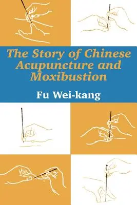 La storia dell'agopuntura e della moxibustione cinese - The Story of Chinese Acupuncture and Moxibustion