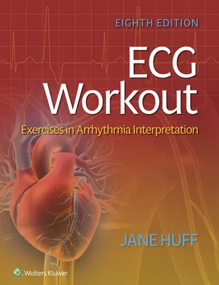 Allenamento ECG: Esercizi di interpretazione dell'aritmia - ECG Workout: Exercises in Arrhythmia Interpretation