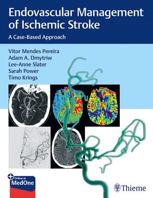 Gestione endovascolare dell'ictus ischemico: Un approccio basato sul caso - Endovascular Management of Ischemic Stroke: A Case-Based Approach