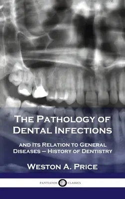 La patologia delle infezioni dentali e la sua relazione con le malattie generali - Storia dell'odontoiatria - Pathology of Dental Infections: and Its Relation to General Diseases - History of Dentistry