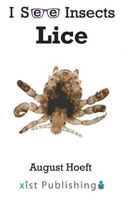 Pidocchio - Lice