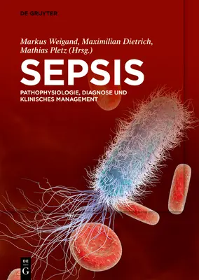 La sepsi - Sepsis