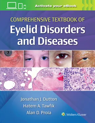 Manuale completo dei disturbi e delle malattie delle palpebre - Comprehensive Textbook of Eyelid Disorders and Diseases