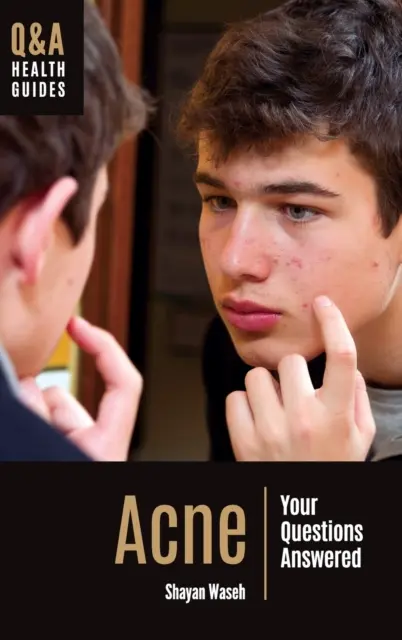 Acne: le vostre domande trovano risposta - Acne: Your Questions Answered