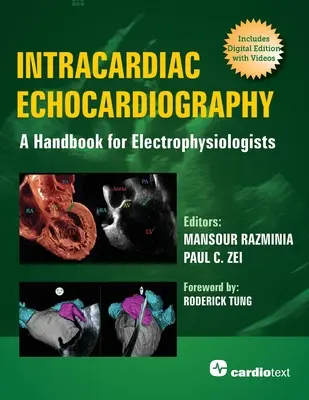 Ecocardiografia intracardiaca: Un manuale per elettrofisiologi - Intracardiac Echocardiography: A Handbook for Electrophysiologists