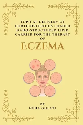 Consegna topica di un vettore lipidico nanostrutturato carico di corticosteroidi per la terapia dell'eczema - Topical Delivery of Corticosteroids Loaded Nanostructured Lipid Carrier for the Therapy of Eczema