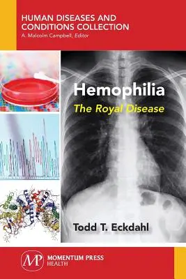 Emofilia: La malattia reale - Hemophilia: The Royal Disease