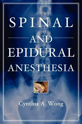 Anestesia spinale ed epidurale - Spinal and Epidural Anesthesia