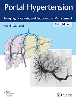 Ipertensione portale: Imaging, diagnosi e gestione endovascolare - Portal Hypertension: Imaging, Diagnosis, and Endovascular Management