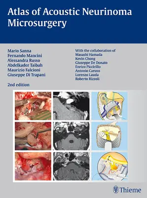 Atlante di microchirurgia del neurinoma dell'acustico - Atlas of Acoustic Neurinoma Microsurgery