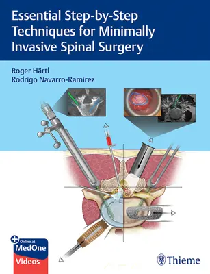 Tecniche essenziali passo-passo per la chirurgia spinale mininvasiva - Essential Step-By-Step Techniques for Minimally Invasive Spinal Surgery
