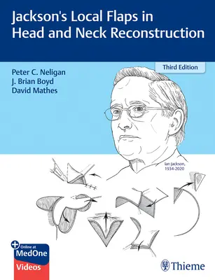I lembi locali di Jackson nella ricostruzione di testa e collo - Jackson's Local Flaps in Head and Neck Reconstruction
