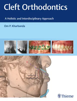 Ortodonzia delle palpebre: Un approccio olistico e interdisciplinare - Cleft Orthodontics: A Holistic and Interdisciplinary Approach