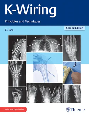 Cablaggio K: Principi e tecniche - K-Wiring: Principles and Techniques