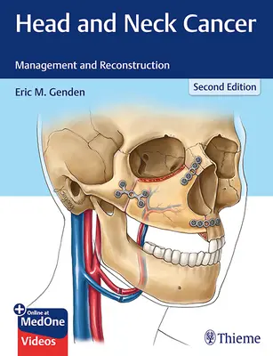 Cancro della testa e del collo: Gestione e ricostruzione - Head and Neck Cancer: Management and Reconstruction