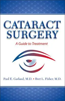 Chirurgia della cataratta: Guida al trattamento - Cataract Surgery: A Guide to Treatment