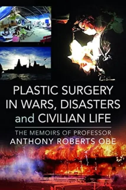 La chirurgia plastica nelle guerre, nei disastri e nella vita civile: Le memorie del professor Anthony Roberts OBE - Plastic Surgery in Wars, Disasters and Civilian Life: The Memoirs of Professor Anthony Roberts OBE