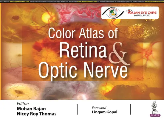 Atlante a colori della retina e del nervo ottico - Color Atlas of Retina & Optic Nerve