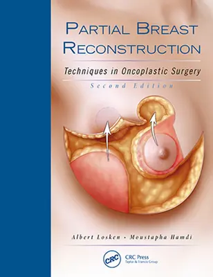 Ricostruzione parziale del seno: Tecniche di chirurgia oncoplastica - Partial Breast Reconstruction: Techniques in Oncoplastic Surgery