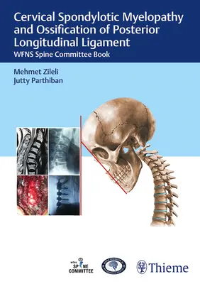 Mielopatia spondilotica cervicale e ossificazione del legamento longitudinale posteriore: Libro del Comitato vertebrale della Wfns - Cervical Spondylotic Myelopathy and Ossification of Posterior Longitudinal Ligament: Wfns Spine Committee Book