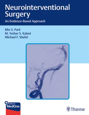 Chirurgia neurointerventistica: Un approccio basato sull'evidenza - Neurointerventional Surgery: An Evidence-Based Approach