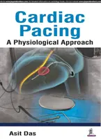 Pacing cardiaco: un approccio fisiologico - Cardiac Pacing a Physiological Approach