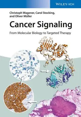 Segnalazione del cancro: Dalla biologia molecolare alla terapia mirata - Cancer Signaling: From Molecular Biology to Targeted Therapy