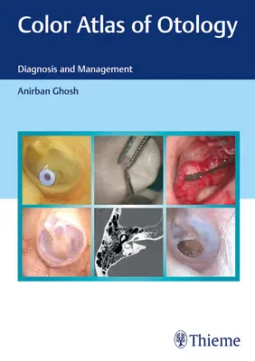 Atlante a colori di otologia: Diagnosi e gestione - Color Atlas of Otology: Diagnosis and Management