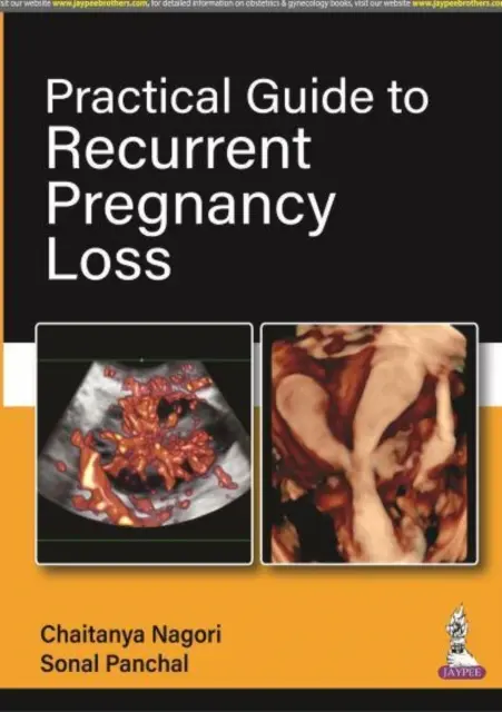 Guida pratica alle perdite ricorrenti di gravidanza - Practical Guide to Recurrent Pregnancy Loss