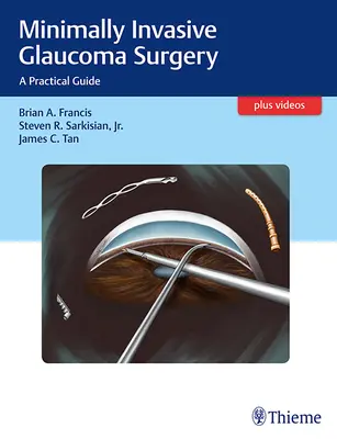 Chirurgia minimamente invasiva del glaucoma: Una guida pratica - Minimally Invasive Glaucoma Surgery: A Practical Guide