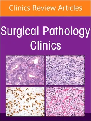 Patologia endocrina, un numero delle Cliniche di Patologia Chirurgica: Volume 16-1 - Endocrine Pathology, an Issue of Surgical Pathology Clinics: Volume 16-1