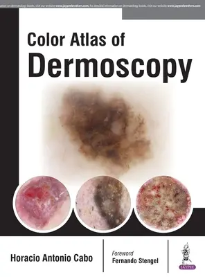 Atlante a colori della dermatoscopia - Color Atlas of Dermoscopy