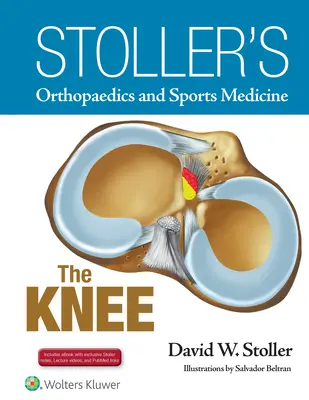 Ortopedia e medicina dello sport di Stoller: Il ginocchio: include i video delle lezioni e gli appunti di Stoller - Stoller's Orthopaedics and Sports Medicine: The Knee: Includes Stoller Lecture Videos and Stoller Notes