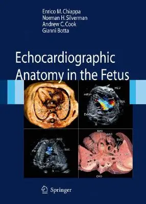 Anatomia ecocardiografica nel feto [Con DVD] - Echocardiographic Anatomy in the Fetus [With DVD]