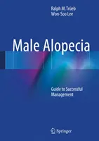 Alopecia maschile: Guida alla gestione di successo - Male Alopecia: Guide to Successful Management